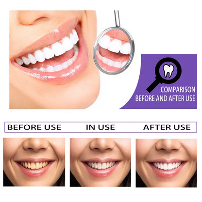 Tooth Whitening Toothpaste for Stain Removal and Brightening
